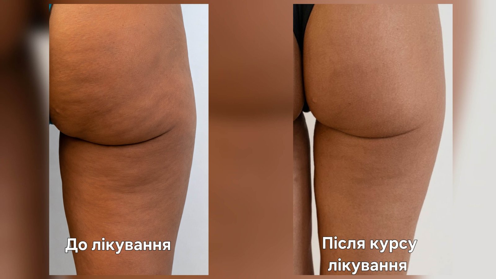 Естетичне моделювання — результат